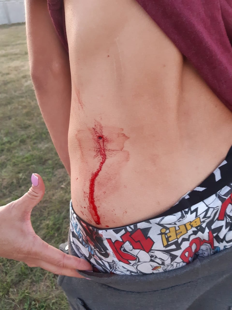 Рана Ярослава/ фото: fb Алексей Прокопенко