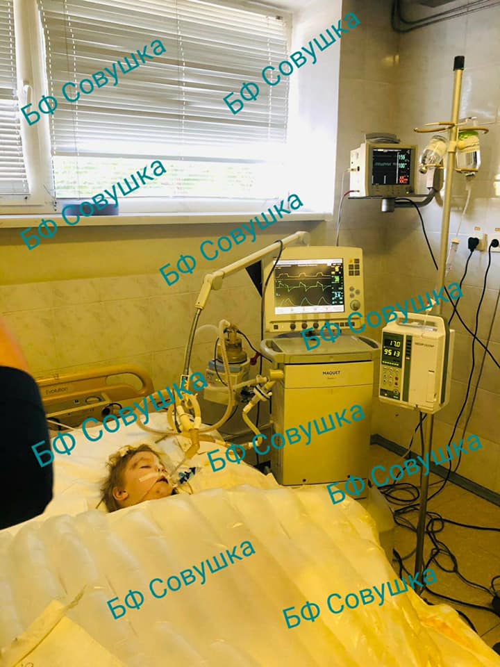 В Днепре спасают малыша, которого сильно покусали собаки / фото: fb Александра Сова-Тимощенкова