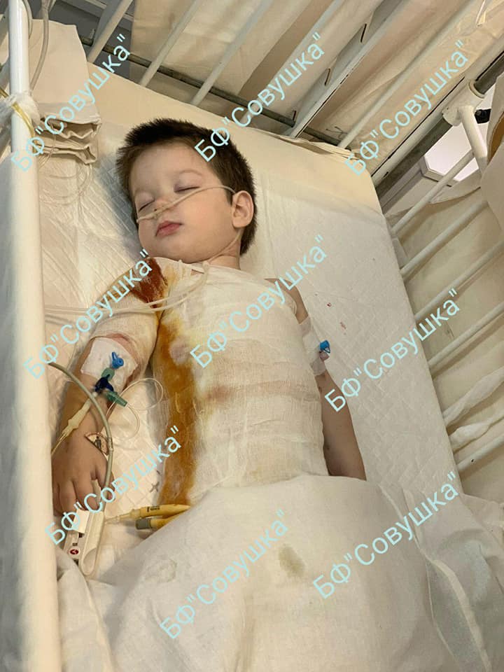 Малыш получил серьезные ожоги / фото: fb Александра Сова-Тимощенкова