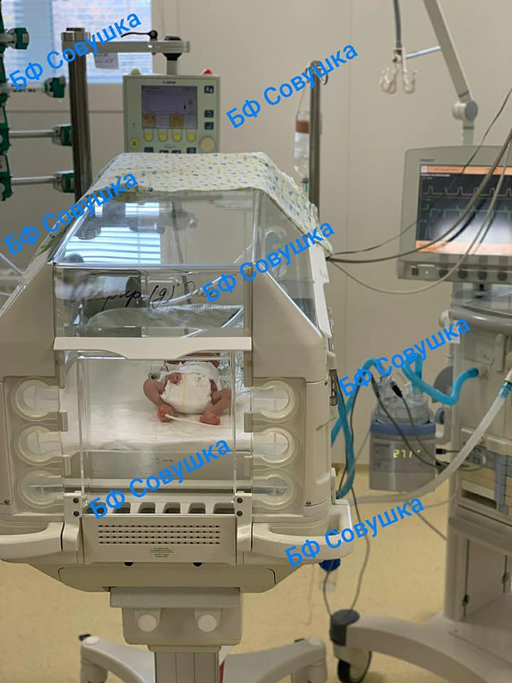 Сейчас крошка находится в реанимации / фото: fb Александра Сова-Тимощенкова