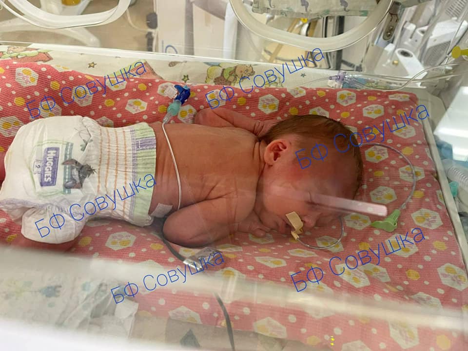 Малышка находится в тяжелом состоянии / фото: fb Александра Сова-Тимощенкова