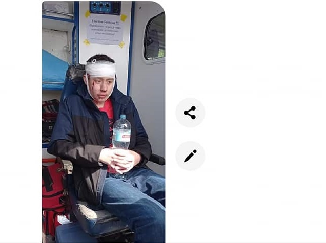 Воры избили мальчика - фото: fb Екатерина Головачева