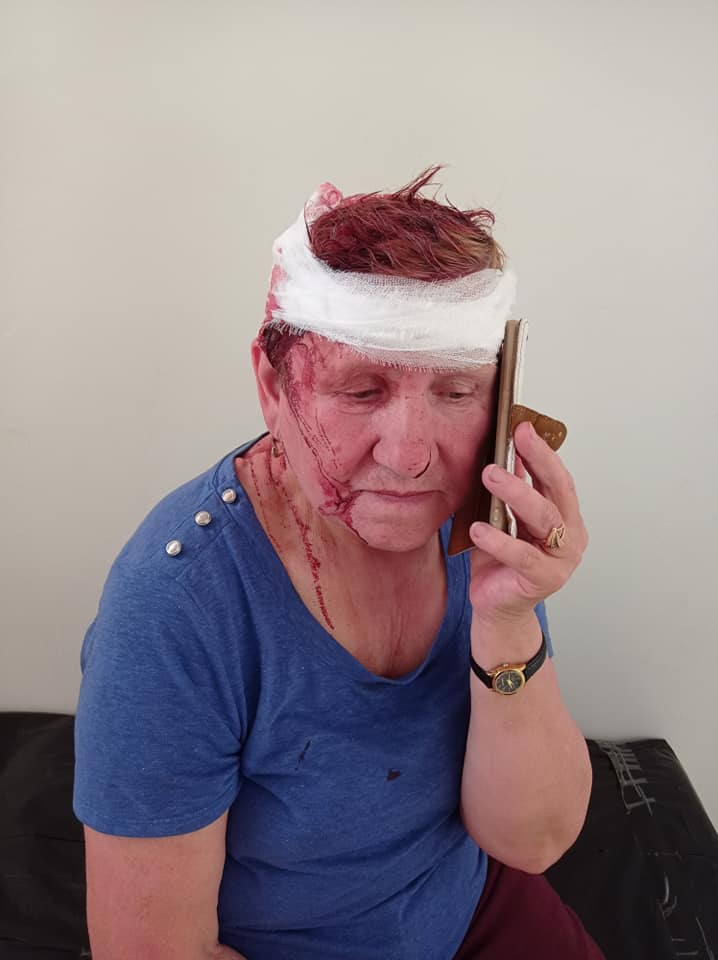 Пострадавшей женщине наложили три шва - фото: fb Ирина Сарана