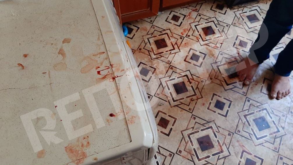 Повсюду кровь / фото: dp.reporter.ua