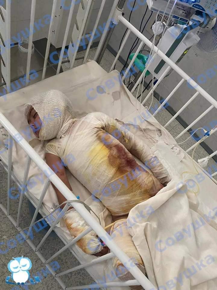 Ребенок сейчас в реанимации - фото: fb БФ «Совушка»