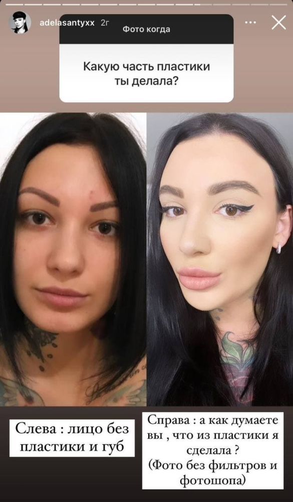 Так Анастасия выглядела до пластики  - фото: tsn.ua