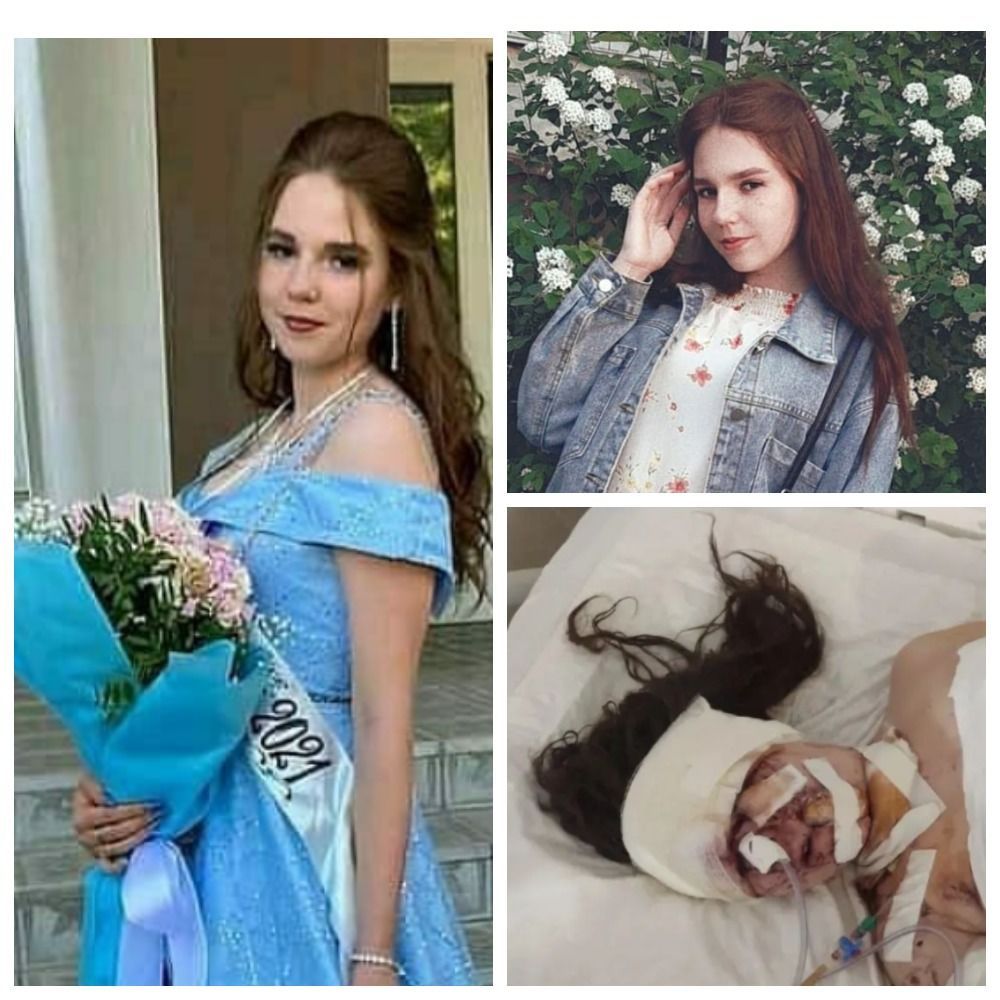 У Дніпрі під час ракетного удару постраждала 19-річна студентка - || фото: tsn.ua