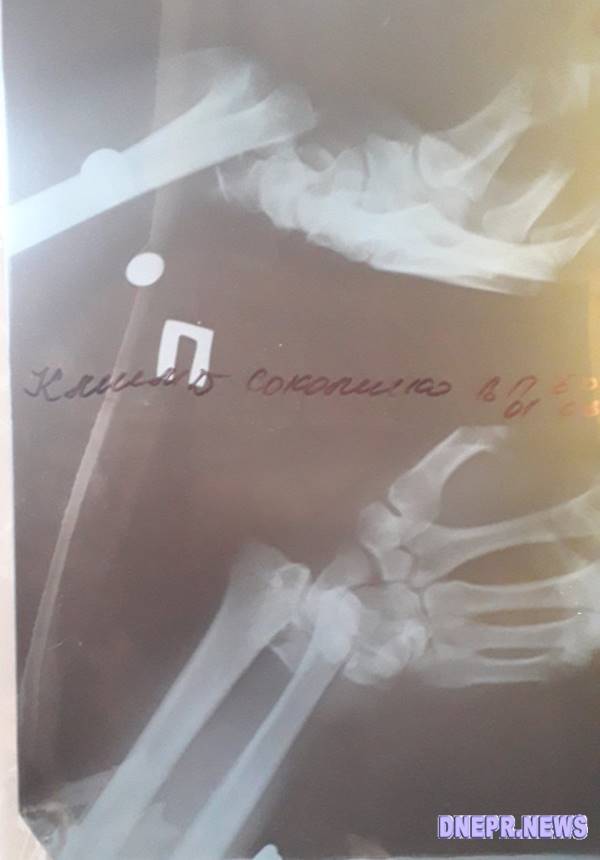 У мужчины серьезная травма / фото: "Новости Днепра"