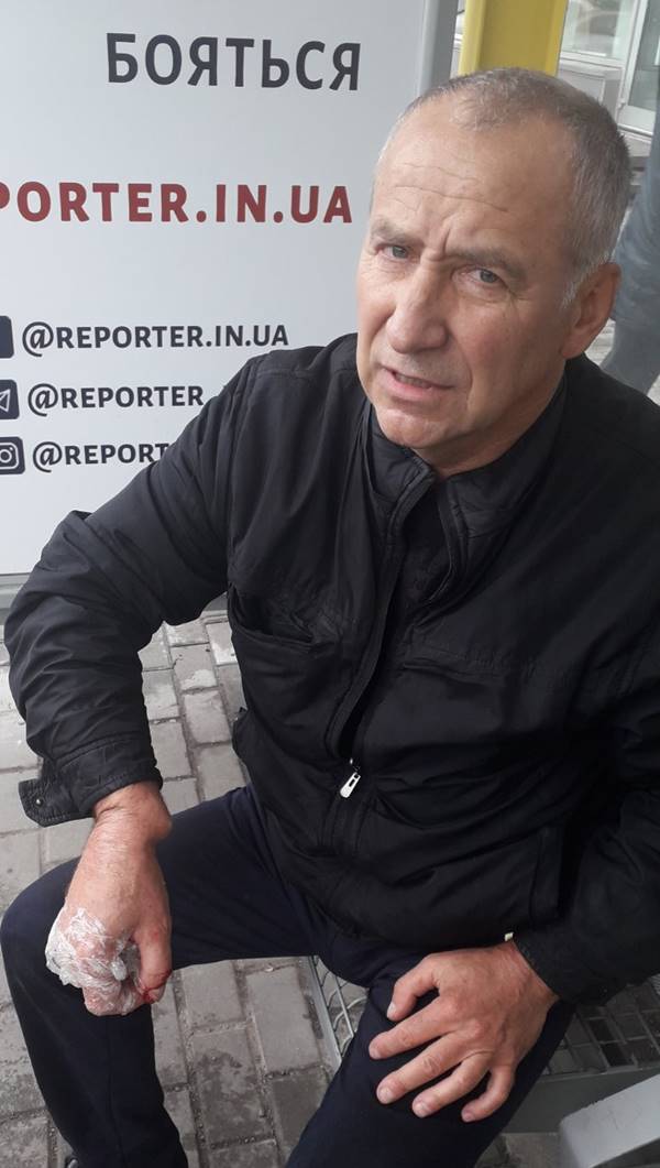 Пострадавший Владимир Соколенко / фото: "Новости Днепра"