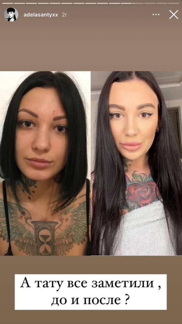 Девушка показала, как выглядела раньше - фото: tsn.ua