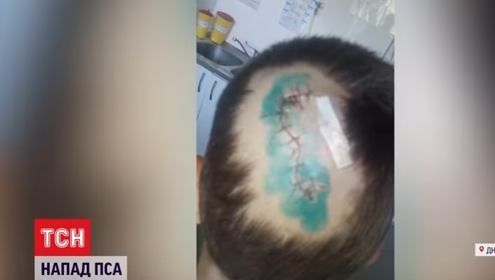 Малыш пробудет в больнице до конца недели / фото: скрин из видео ТСН