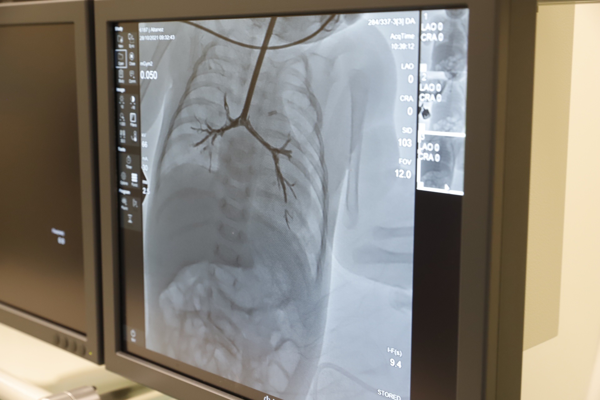 У девочки выявили серьезные проблемы со здоровьем - фото: dniprorada.gov.ua