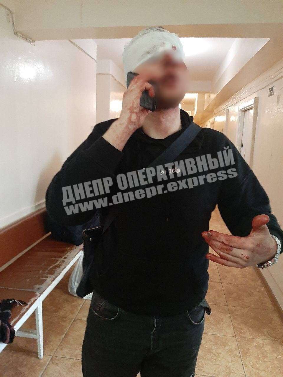 Пострадал водитель  / фото: dnepr.express