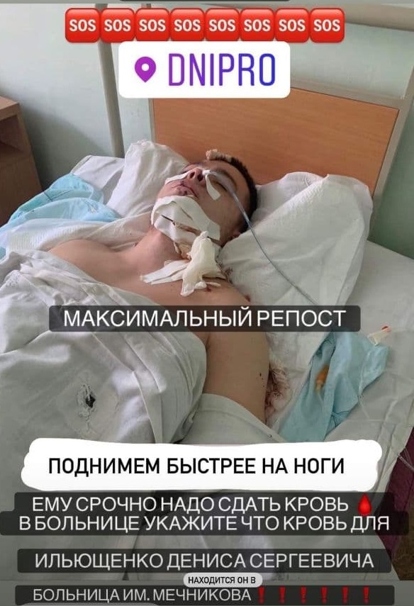 Одному из парней нужна донорская кровь / фото: fb Валерий Выгонский
