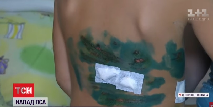 Маленького мальчика покусала соседская овчарка / фото: скрин из видео ТСН