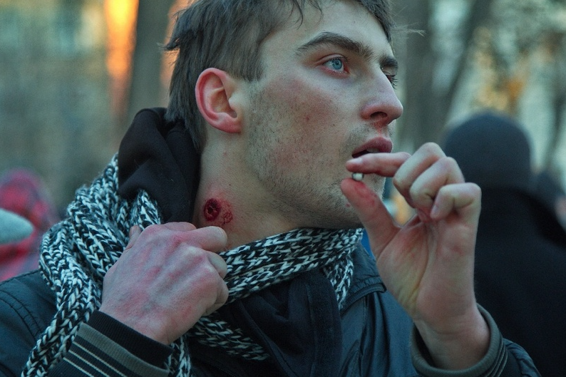 Ранили мужчину / фото: Денис Моторин