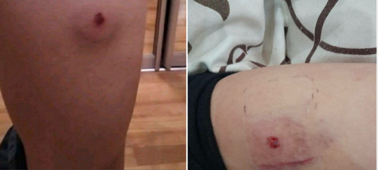 У Дніпрі стріляють по дітям