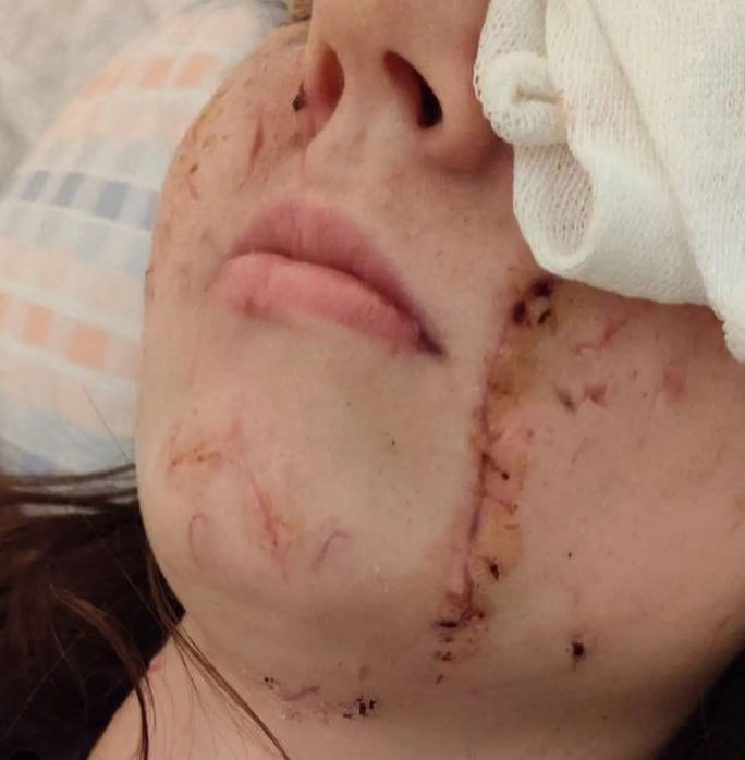 19-летней Анне Котовой нужна помощь, чтобы спасти зрение