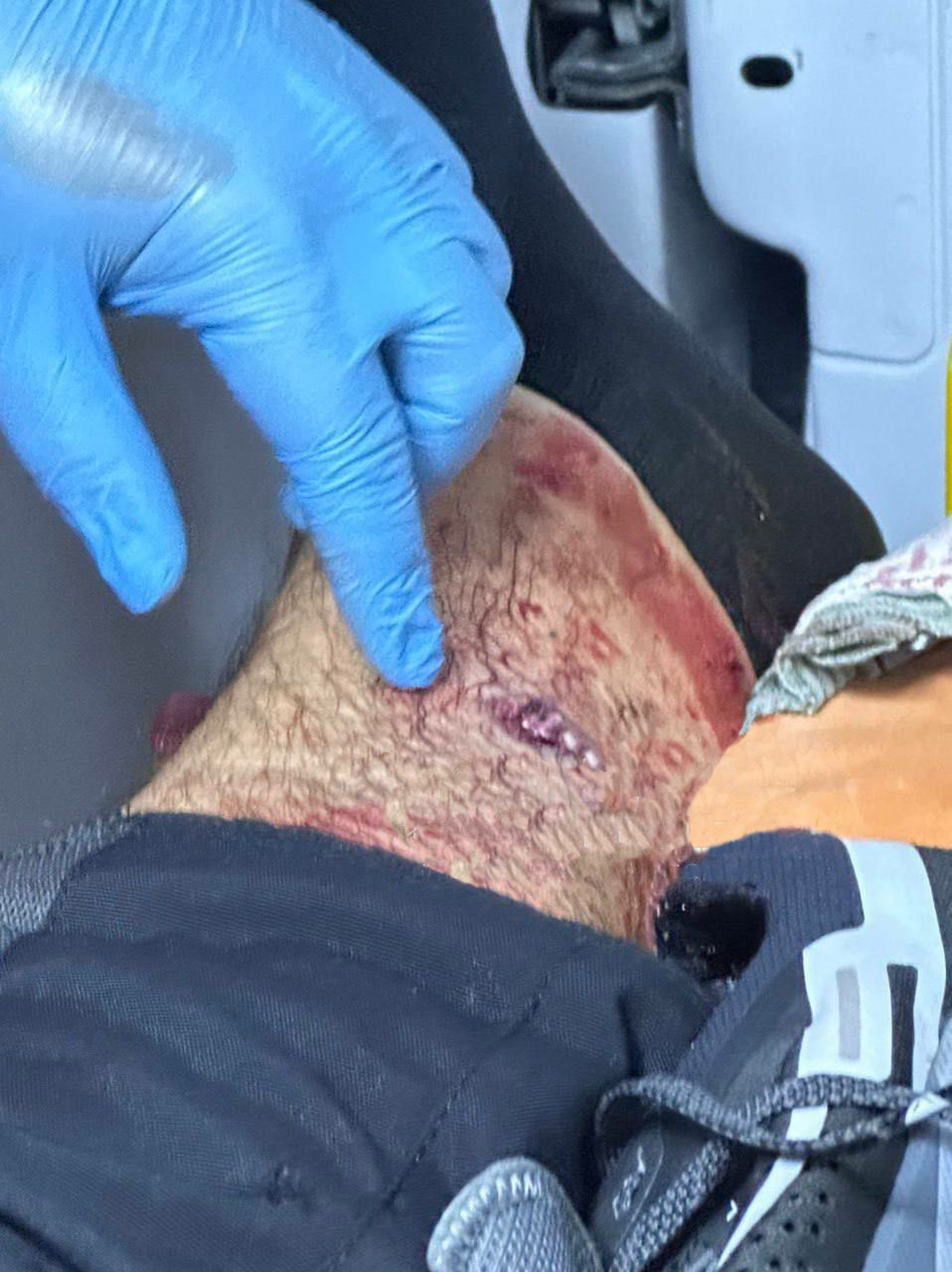 "Мало стрелял!": Девушка, спасшая на Победе во время ракетного удара, вместе с парнем устроили ДТП со стрельбой фото