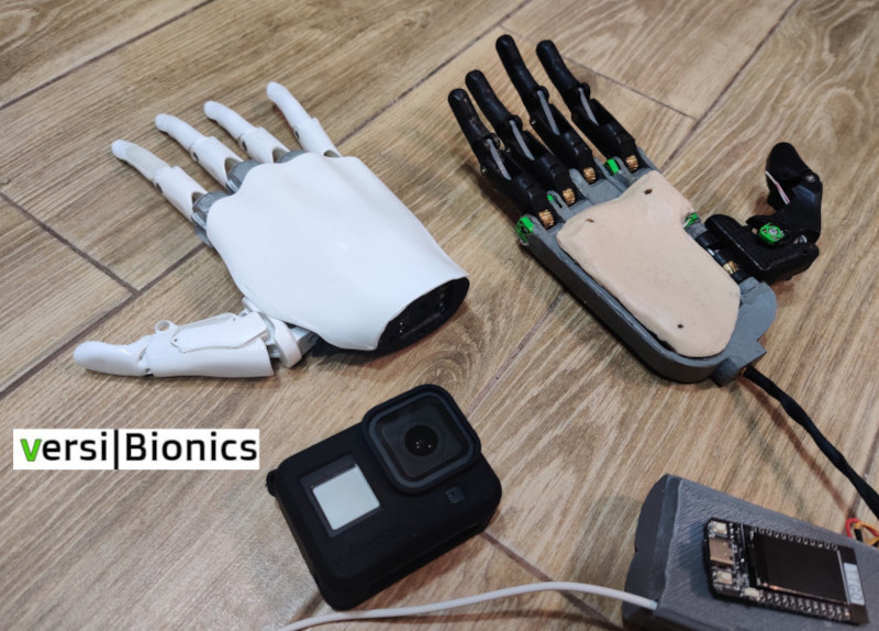 Не має аналогів у світі: у Дніпрі розробили біонічний протез