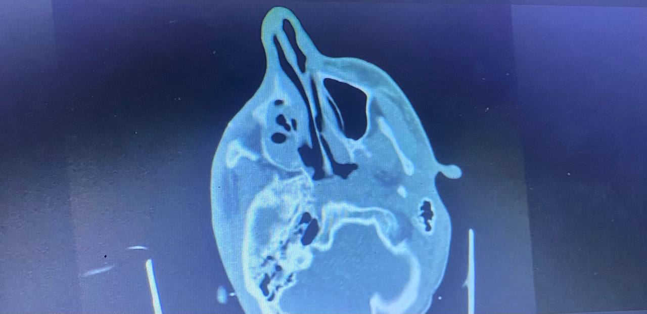 В Днепре спасли артиллериста-нацгвардейца Андрея из Тернополя