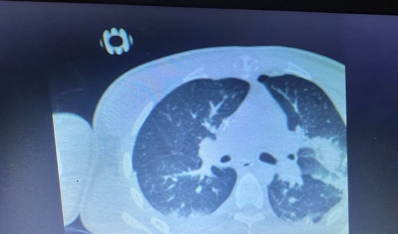 В Днепре спасли артиллериста-нацгвардейца Андрея из Тернополя