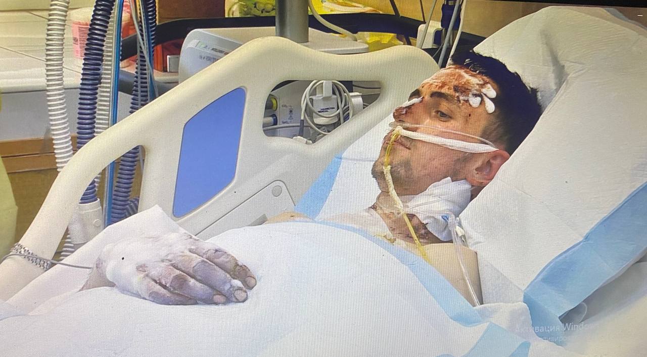 В Днепре спасли артиллериста-нацгвардейца Андрея из Тернополя